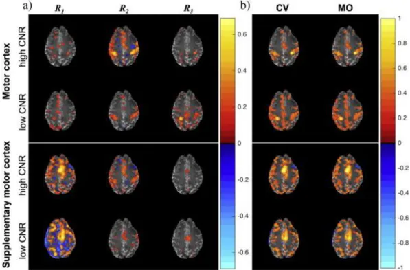 Fig. 3. Experimental MO fMRI spatial correlation maps for each seed voxel (a) by the  correlation bands, R 1 , R 2 , R 3  corresponding to the frequency band ranges 0.0009–