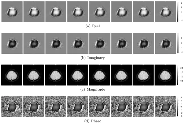 Figure 2.1 Images of the (a) real, (b) imaginary, (c) magnitude, and (d) phase data for time points 5, 9, 13, 17, 21, 25, 29, and 33 (moving left to right), which represent the first complete 32-s cycle of the finger-tapping experiment, containing 16-s per