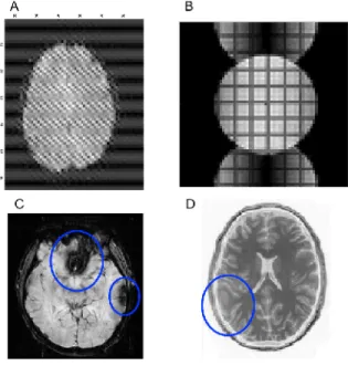 Figure 2.6: Common artifacts example in fMRI data. A): k-space artifact. B) Ghosting in a phantom