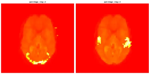 Figure 1: PPM images for slice 3 of the fmri data set: (a) areas of visual stimulation; (b) areas of auditory stimulation.