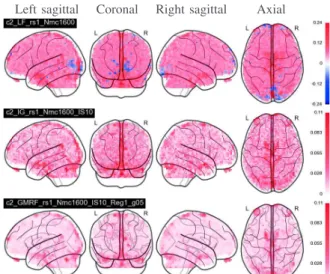 Fig. 1. Resting state (−c 2 )-maps estimated from the LF, IG and GaMRF procedures (top to bottom).