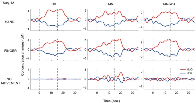 Fig. 4. Time series of reconstructed cortical HbO/HbR concentration changes at the peak voxel on left primary motor cortex in subject 12, for the three task conditions