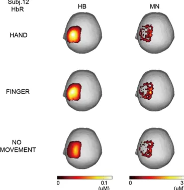 Fig. 6. Time series of reconstructed scalp HbO/HbR concentration changes from subject 12 in the three task conditions