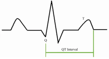 Figure 1. QT interval in ECG signal.