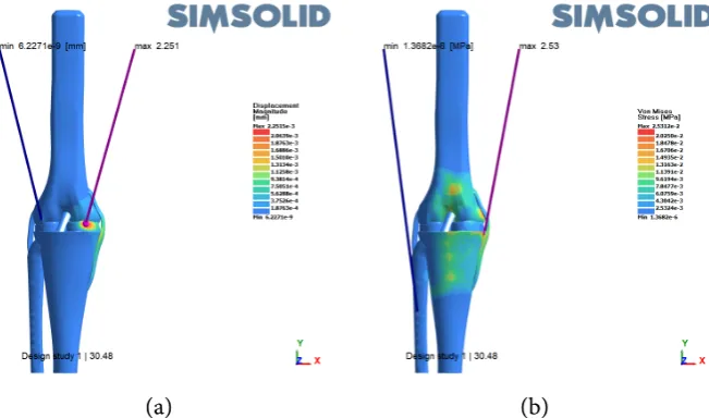 Figure 7. (a) Displacement magnitude for 33.8 N force; (b) Von Mises stress for 33.8 N force