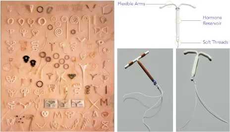 Figure 1.1 Bottom Right: The Mirena IUD, Photo Credit: Jamie Chung Figure 1.2 Bottom Left: The Paragard IUD, Photo Credit: Jamie Chung Figure 1.3 Left:  The IUD Collection at the Percy Skuy History of Contraception Gallery, Dittrick Medical History Center,