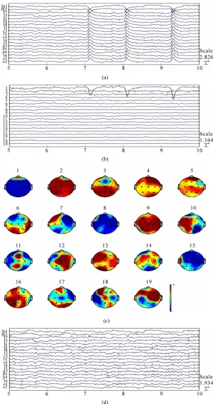 Figure 1. Demonstration of ocular artifact removal using ICA in EEG signals. (a) A five-second epoch of a nineteen-channel EEG time series containing prominent arti-fact due to eye movement; (b) Corresponding ICA component activations and (c) scalp map of 