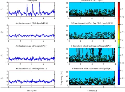 Figure 3the raw signal and the reconstructed signal is shown in . The PSD of S-transform based reconstructed signal almost replicates the PSD of the raw signal be  
