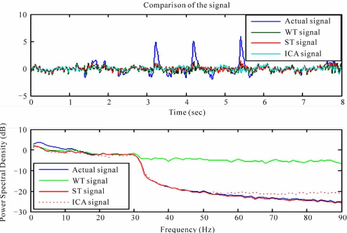 Figure 3. Comparison of artifacts free signals using ICA, WT, ST in time domain and their PSD
