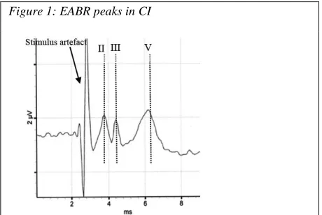 Figure 1: EABR peaks in CI 