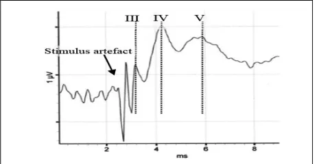 Figure 1.5: depicts 111 1V and V peak in ABI 