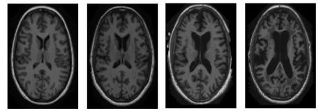 Figure (4.3) Sample Images From OASIS Dataset.