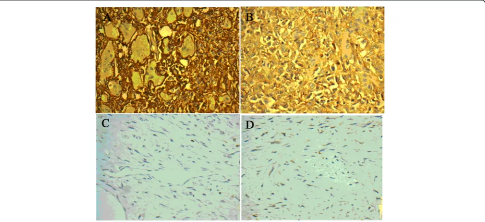 Table 2 Expression of ezrin, CD44, and VEGF in different tissues