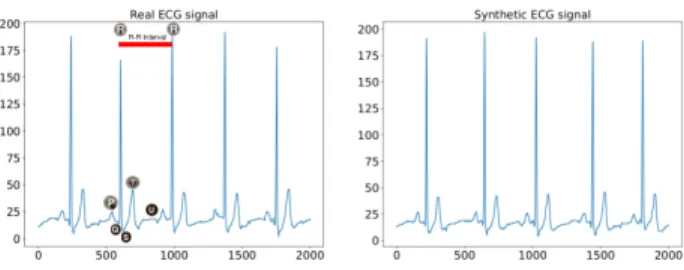 Fig. 4. Real ECG signal vs synthetic output generated by a multi-layer recurrent neural network.
