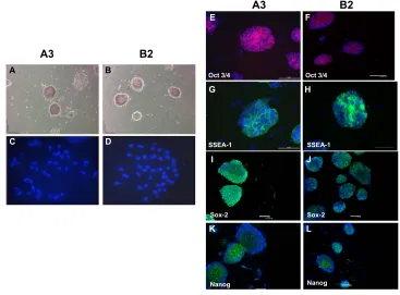 Figure 2 ESC stain positive for markers consistent with undifferentiated stem cells.(Abbreviations:Notes: (A and B) The A3 and B2 ESC lines, respectively, display typical ESC colony morphology and display high levels of alkaline phosphatase activity