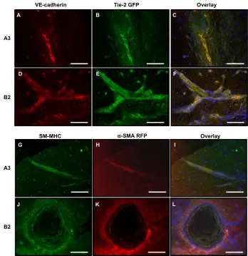 Figure 5 Embryoid bodies (EB) develop vascular Tie-2 GFP+ and α-SMA RFP+ cells.Notes: The differentiating EB of (A–D) A3-ESC and (E–H) B2-ESC from day 7 through 21
