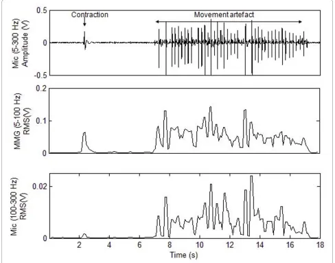Figure 2 Signal denoising. The microphone signal and RMS values of the low-frequency (MMG) and high-frequency filtered signals during contrac-tion and movement.