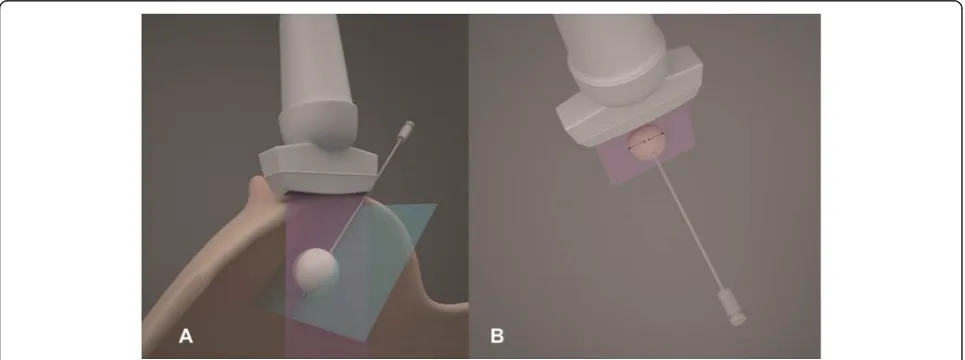 Figure 1 Marking needle.