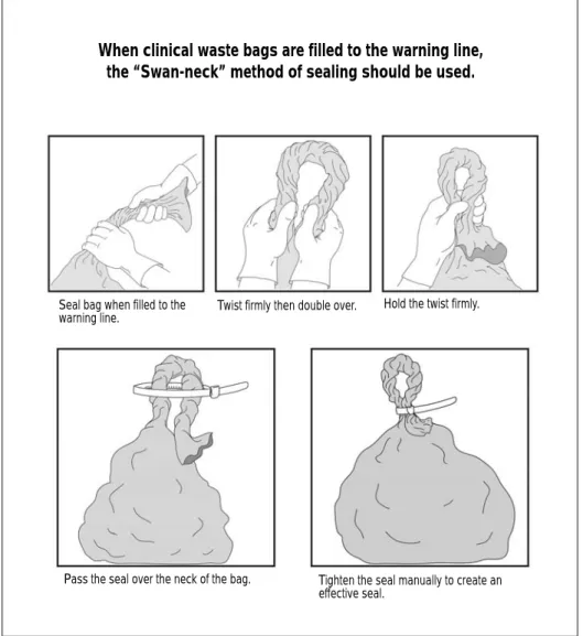 Figure 1: Sealing Method for Clinical Waste Bags. 