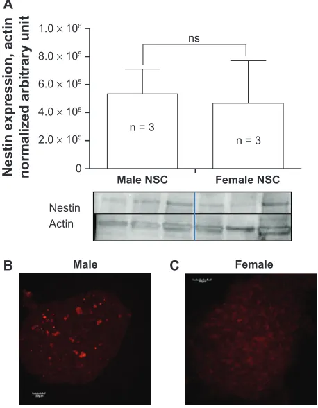 Figure 1 Nestin expression in undifferentiated NSCs. Quantification of nestin expression from three different rats of each gender