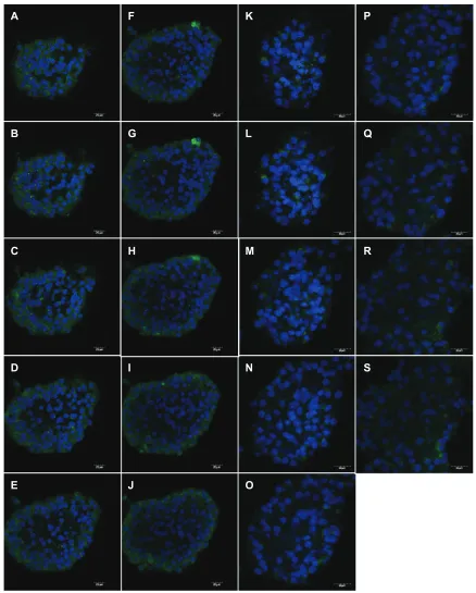 Figure 3 Aromatase differential expression in undifferentiated male and female nSCs. Aromatase expression was visualized on consecutive layers by confocal microscopy on nSCs isolated from the SVZ of three-month-old male (Abbreviations: A–J) and female (K–S) rats and grown as neurospheres.nSC, neural stem cell; SVZ, subventricular zone.