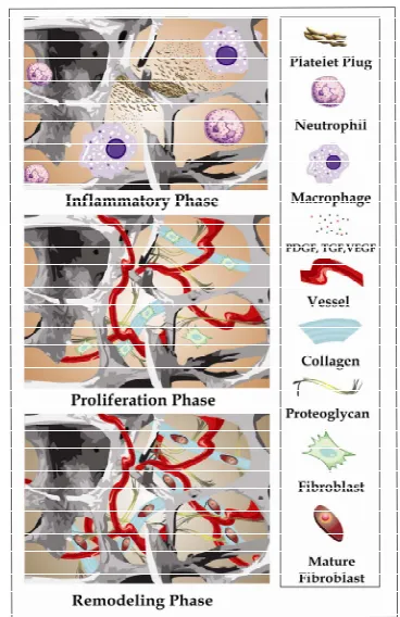 Figure 2. Stages of process bone tissue repair. Inflamma- tory, proliferative and remodeling phases