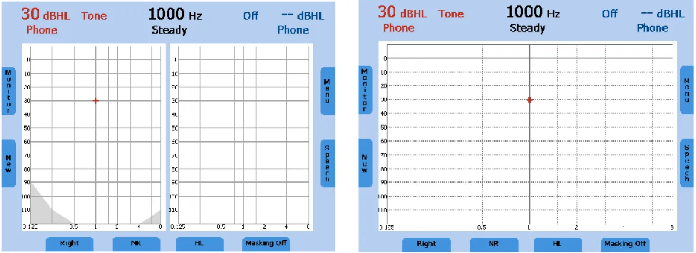 Figure 4 - Start Screen Tone Audiometry Examples (Dual and Single Audiogram) 