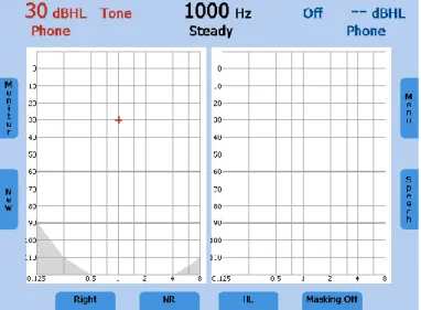Figure 5 - Pure Tone Audiometry Screen Example 