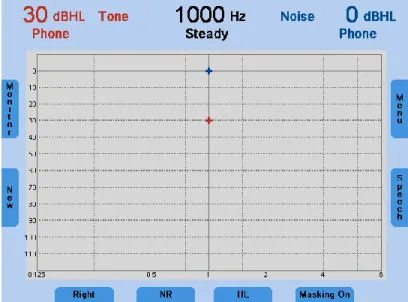 Figure 6 - Tone Audiometry with Masking 