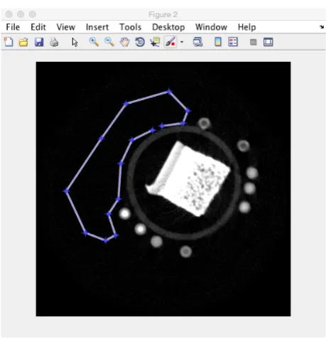 Figure 9: A popup window allows the user to draw a polygon around part of the CT image which is usedto create the covariance matrix.