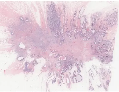 Figure 1-2 A whole slide image at a ×1.0 magnification scale [10] 