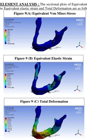 Figure 9(A) Equivalent Von Mises Stress 