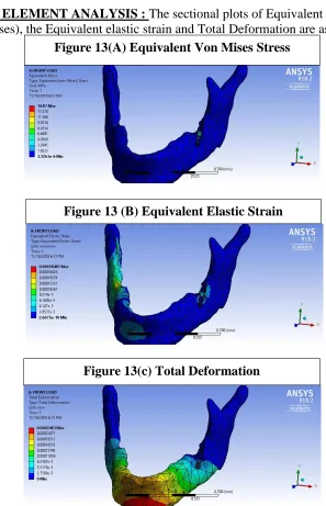 Figure 13(A) Equivalent Von Mises Stress 