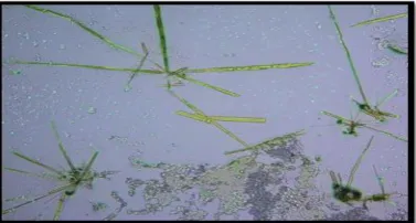 Figure 3: Wagner’s Reagent:  Needle and Rod shaped crystals 