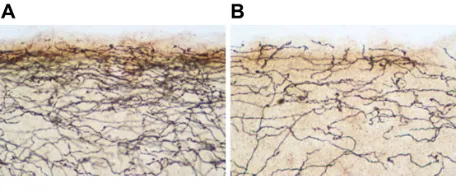 Figure 1 Photomicrograph of serotonin transporter-immunoreactive axons in the upper layers of occipital cortex of a control rat (A) compared to a 3,4-methylenedioxymethamphetamine (MDMA)-treated rat (B).
