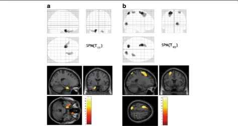 Fig. 3 FDG38), and right superior temporal gyrus (BA 38 and 32) compared with baseline in the intervention group (walking, activations after the 3-month exercise program were prominent in the left posterior entorhinal cortex (BA 28), left superior temporal