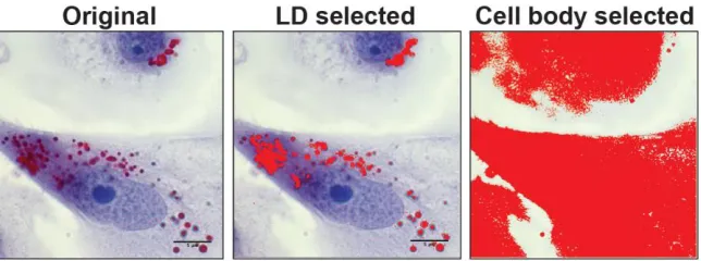 Figure 2.4.2 Selection of LDs and cell body for ImageJ analysis  