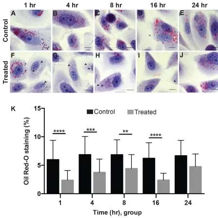 Figure 2.5.1 Oil Red-O Quantification of stained PC3 cells at various timepoints. Representative images of monolayer culture of PC3 cells under control (A-E) and treated (F-J) at 