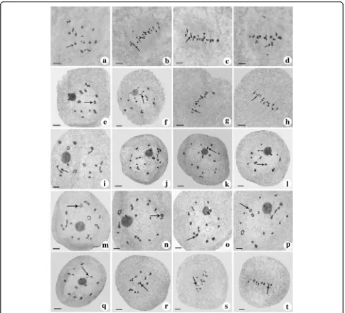 Fig. 2 Chromosome configuration at diakinesis and metaphase I.shape) + 8II;1 frying pan shape (arrow) + 1 X shape) + 12II;2I;frying pan shape (arrow) + 1 OK shape+ 2 X shape) + 2II;ring shape + 4 X shape + 1 chain shape (arrow)) +6II;(arrow) + 3 X shape) +