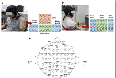 Fig. 2 Electrode Configurations for sEMG and EEG recordings on subjects with different amputated statuses