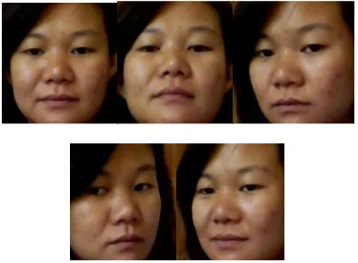 Figure.8.Five different images for a single face image  