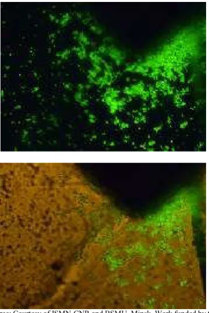 Figure 11. Cell attraction to magnet placed below culture dish 