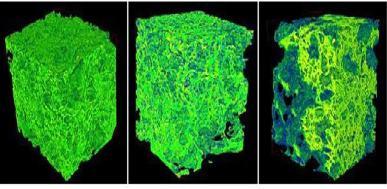 Figure 13. Microtomographic reconstruction of glass-ceramic scaffold (scaffold – green, new phase - blue)