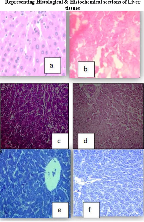Fig 14.  Representing the hematoxyline eosin(a,b) , PAS(c,d) ,     degenerated cell morphologies of the respective hepatocytes,  whereas “d” and “f” denotes the diffrenece in protein and  Bromophenol(e,f) stained histological & histochemicall slides of normal and treated albino rats .“a” , “c” , “e” denotes the normal histology and histochemistry of liver from the control rat whereas “b” denotes the treated rat’s liver histology  which shows  glycogen content respectively of the treated rats 