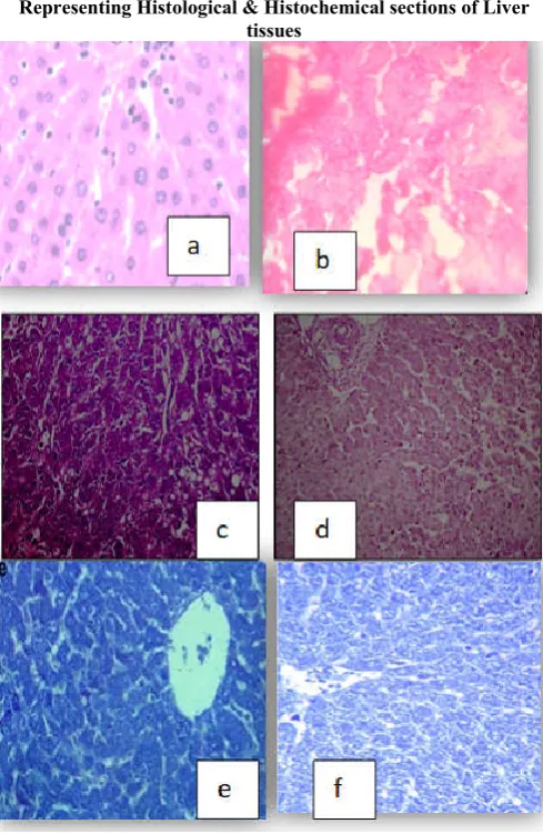 Fig 14.  Representing the hematoxyline eosin(a,b) , PAS(c,d) ,     degenerated cell morphologies of the respective hepatocytes,  whereas “d” and “f” denotes the diffrenece in protein and  Bromophenol(e,f) stained histological & histochemicall slides of normal and treated albino rats .“a” , “c” , “e” denotes the normal histology and histochemistry of liver from the control rat whereas “b” denotes the treated rat’s liver histology  which shows  glycogen content respectively of the treated rats 