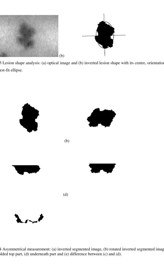 Fig. 3 Lesion shape analysis: (a) optical image and (b) inverted lesion shape with its centre, orientation and  the best-fit ellipse