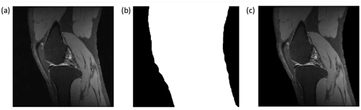 Figure 8: The result image of pre-processing step (a) Original image (b) ROI mask  image and (c) pre-processed image 