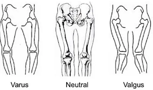 Figure 2-8. Tibial position in varus (left), neutral (middle), and valgus (right) alignment