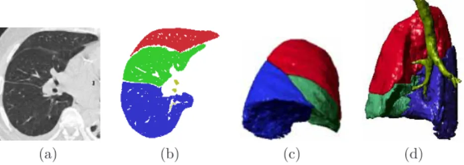 Fig. 5. Segmentation of the right lung in CT. (a): representative 2D slice of original 3D data