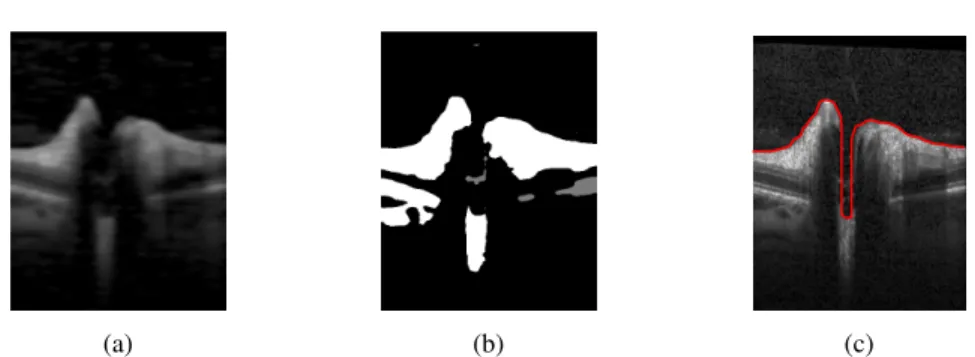 Fig. 4. Three processing steps to obtain initial segmentation: a) filtering with morphological and Gauss filter b) thresholding, neglecting small connected components c) the initial contour